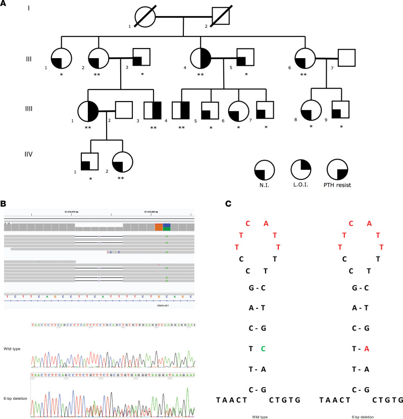 Recurrent small variants in NESP55/NESPAS associated with broad GNAS methylation defects and pseudohypoparathyroidism type 1B.