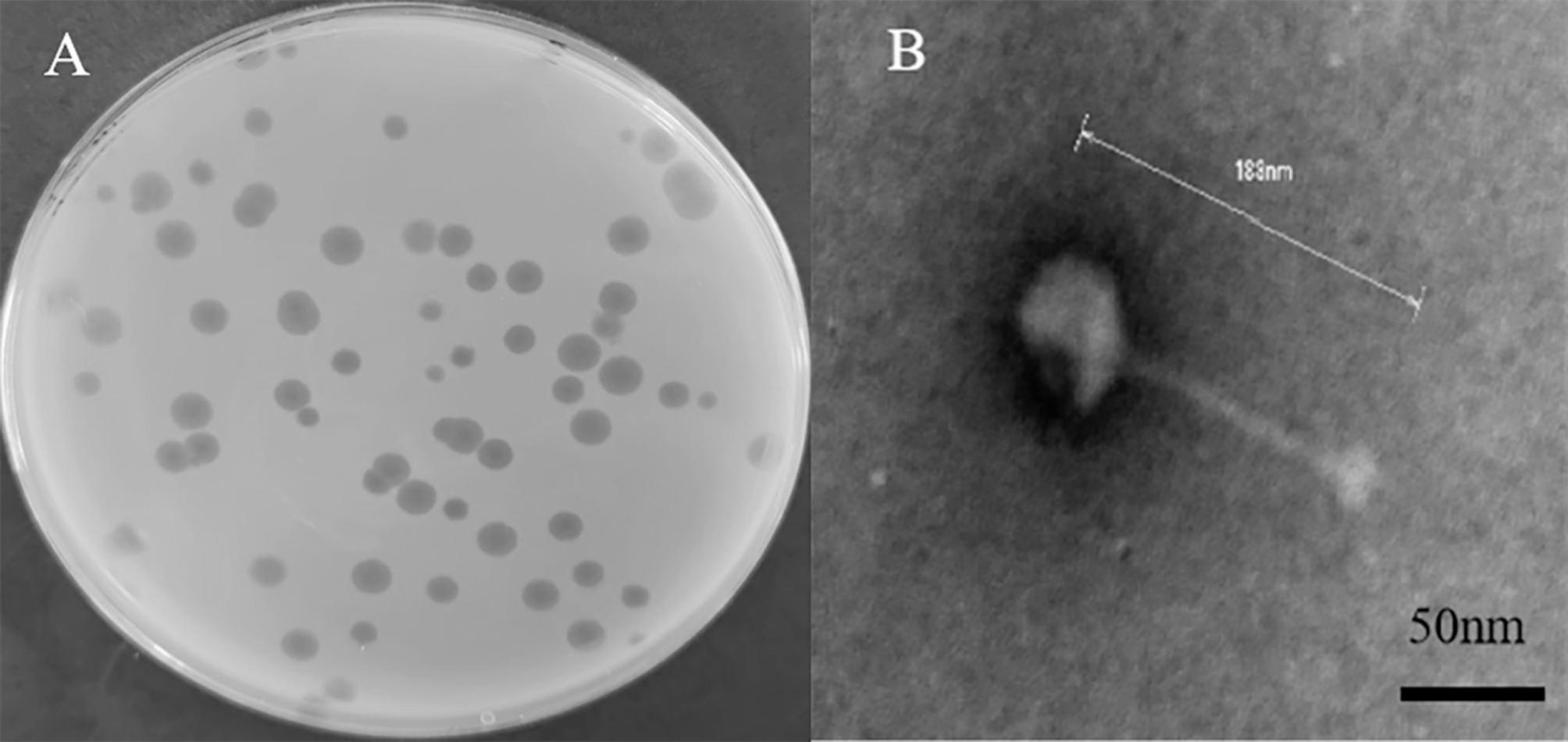 Protective effect of phage pSal-4 on chicken intestinal epithelial cells injured by Salmonella enteritidis.