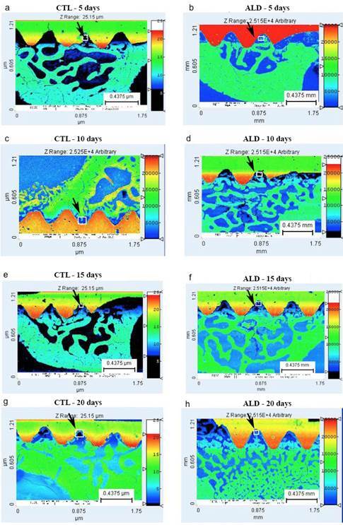 Effect of Long-Term Treatment with Alendronate on Bone Repair and Mineralization Around Implants in Rats.