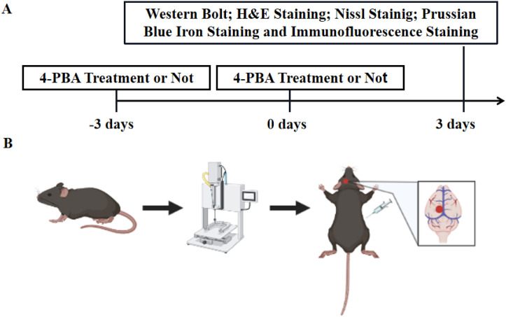 Valproic Acid Inhibits Endoplasmic Reticulum Stress and Reduces Ferroptosis After Traumatic Brain Injury.