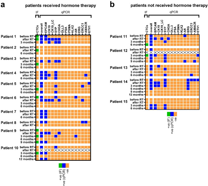 Multi-marker analysis of circulating tumor cells in localized intermediate/high-risk and metastatic prostate cancer.