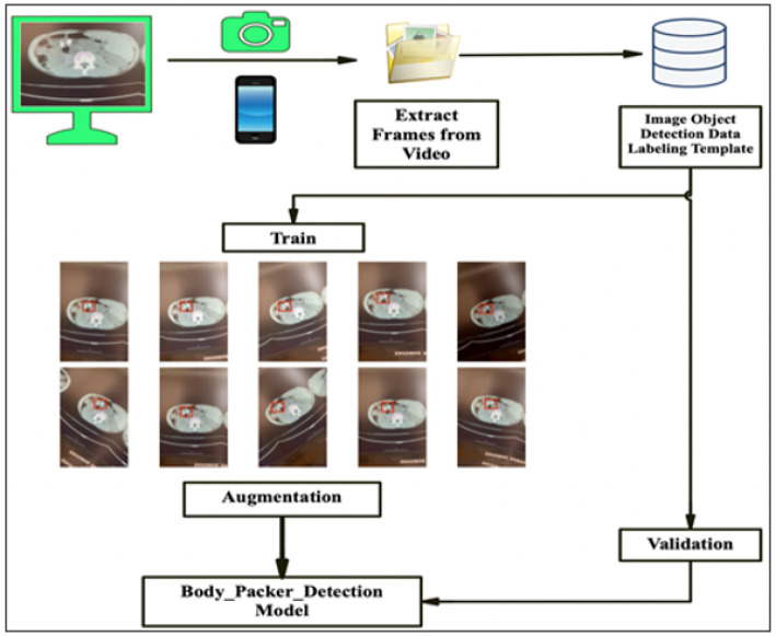Detection of Body Packs in Abdominal CT scans Through Artificial Intelligence; Developing a Machine Learning-based Model.