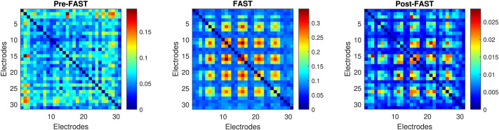FAST functional connectivity implicates P300 connectivity in working memory deficits in Alzheimer's disease.