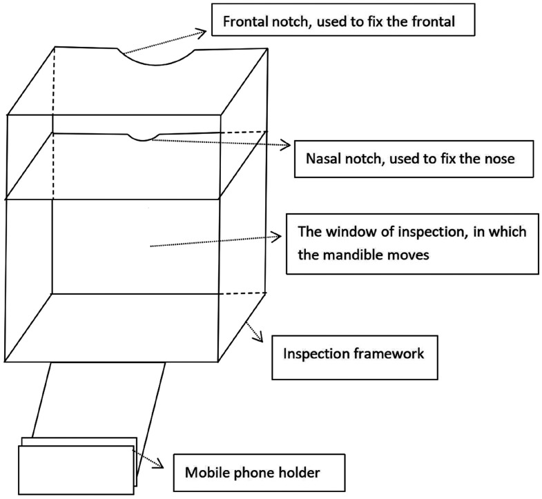 Dynamic automated assessment of functionally limited temporomandibular disorders using motion analysis.