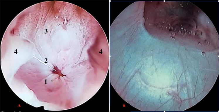 Endoscopic techniques for early diagnosis of cloacal pathologies and sex determination in blue spotted tree monitor (<i>Varanus macraei)</i> and Cuming's water monitor (<i>Varanus cumingi)</i>.