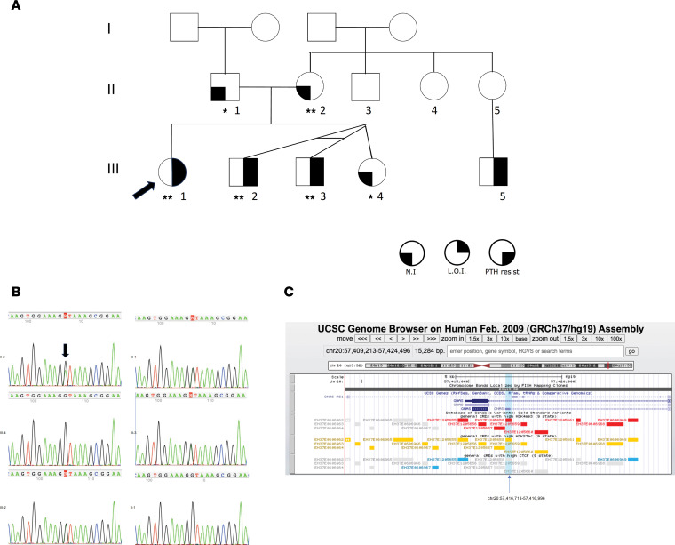 Recurrent small variants in NESP55/NESPAS associated with broad GNAS methylation defects and pseudohypoparathyroidism type 1B.