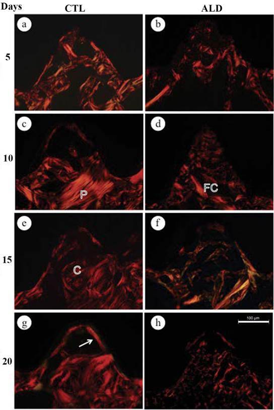 Effect of Long-Term Treatment with Alendronate on Bone Repair and Mineralization Around Implants in Rats.