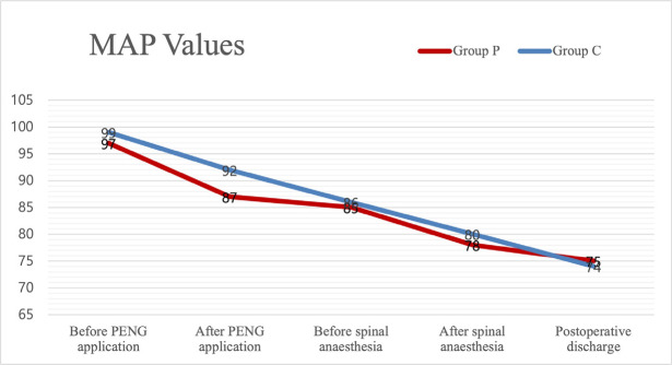 Efficacy of Preoperative Pericapsular Nerve Group Block in Patients with Hip Fracture and its Effect on the Success of Spinal Anaesthesia: A Retrospective Study.