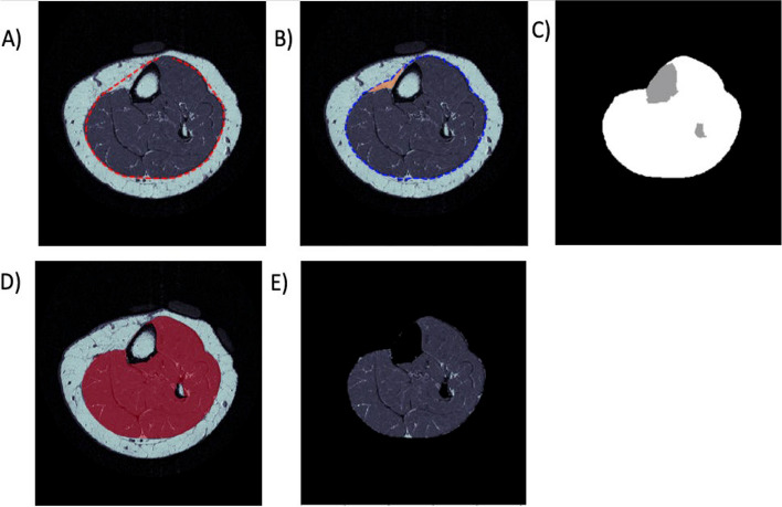 Fully-automated segmentation of muscle and inter-/intra-muscular fat from magnetic resonance images of calves and thighs: an open-source workflow in Python.
