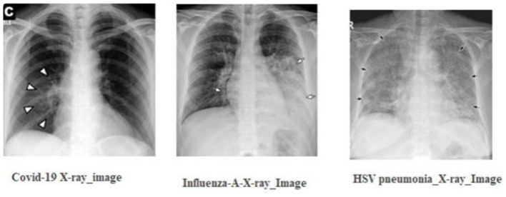 Leveraging compact convolutional transformers for enhanced COVID-19 detection in chest X-rays: a grad-CAM visualization approach.