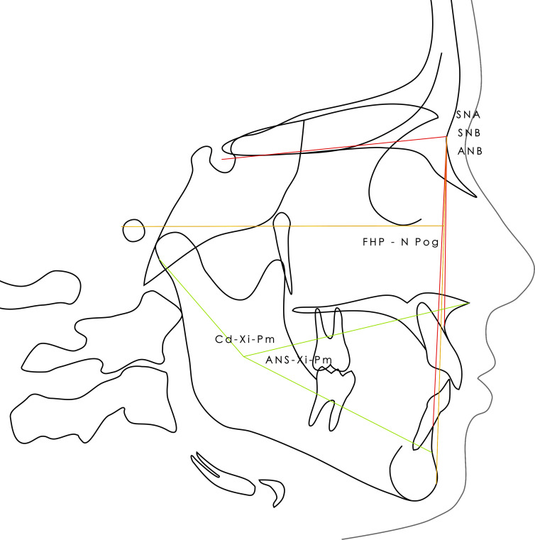 Association between dental agenesis and facial morphology. A cross-sectional study in France.