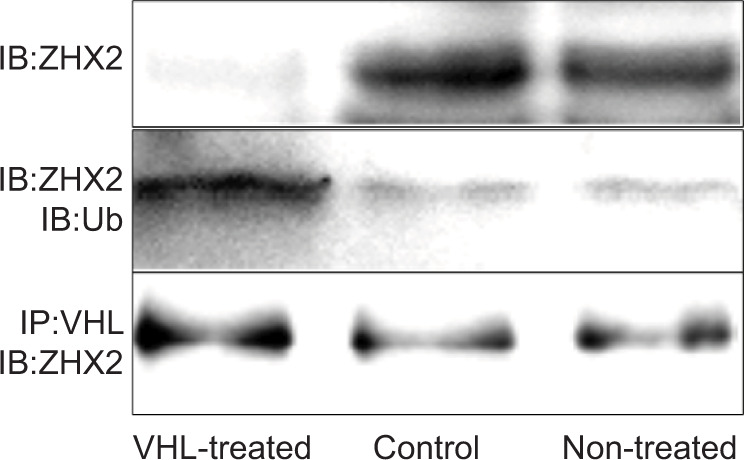 Relationship between ZHX2 Expression and VHL Gene Alteration in VHL-associated and Sporadic Hemangioblastomas of the Central Nervous System.