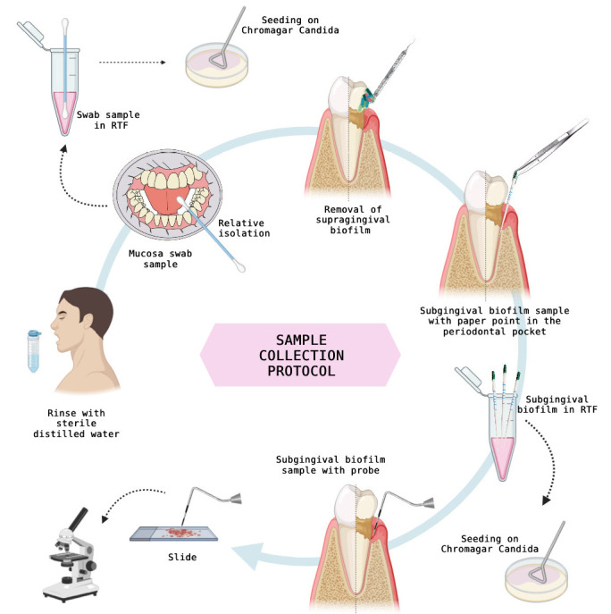 Subgingival biofilm colonization by Candida albicans and Candida dubliniensis in patients living with HIV from Buenos Aires, Argentina.