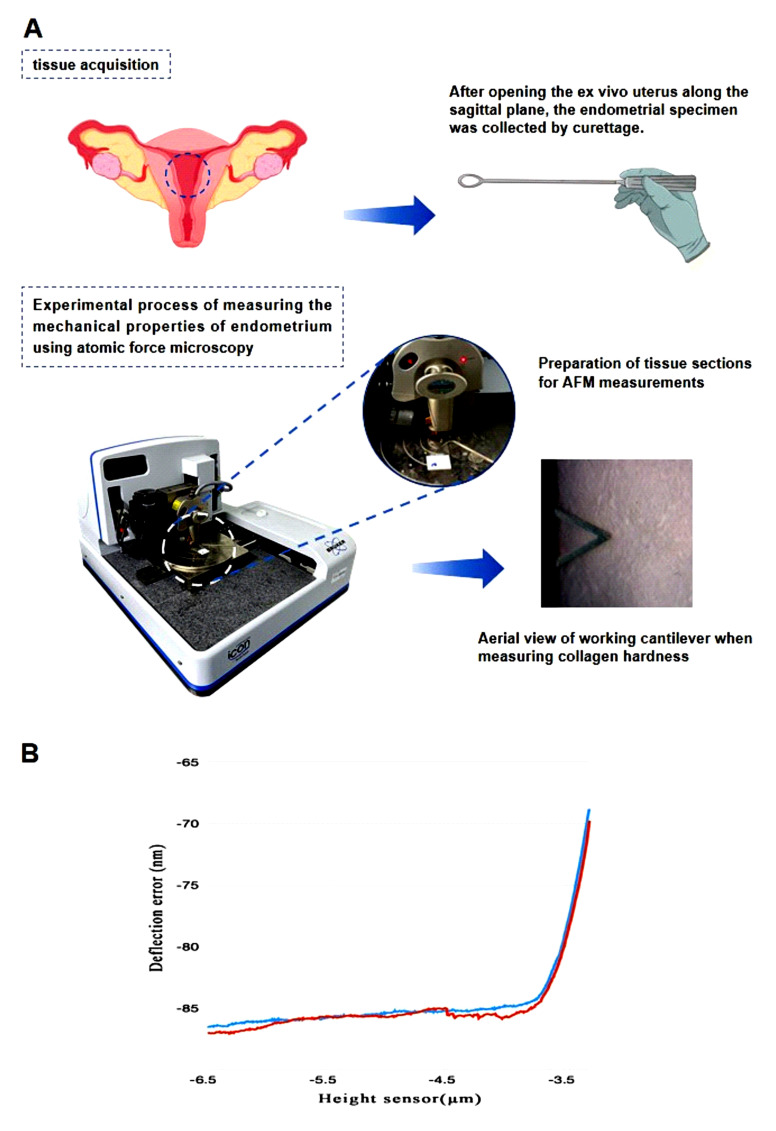 The matrix stiffness is increased in the eutopic endometrium of adenomyosis patients: a study based on atomic force microscopy and histochemistry.