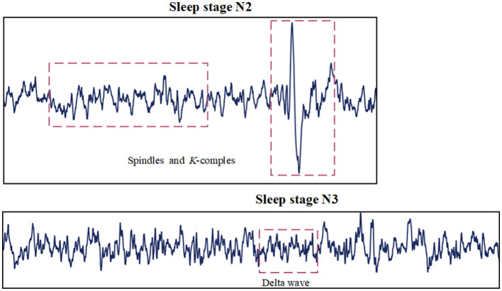 Multimodal sleep staging network based on obstructive sleep apnea.