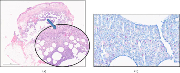 A Novel, Nonaquatic Zoonotic Transmission of <i>Mycobacterium marinum</i>.