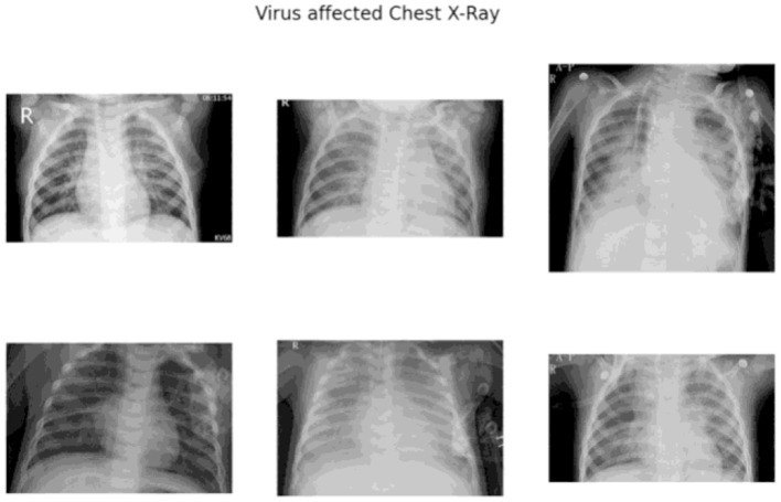 Leveraging compact convolutional transformers for enhanced COVID-19 detection in chest X-rays: a grad-CAM visualization approach.