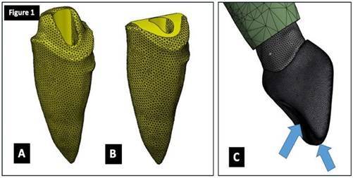 Comparative finite element analyses of stress exerted on the dentin by intraradicular posts.