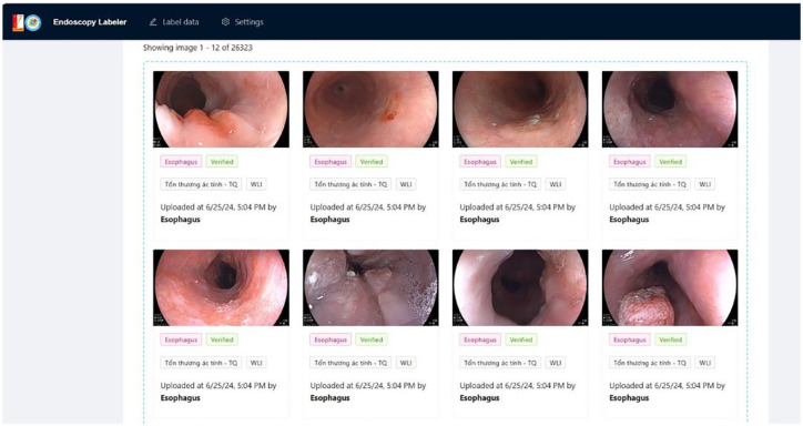 Application of artificial intelligence in gastrointestinal endoscopy in Vietnam: a narrative review.
