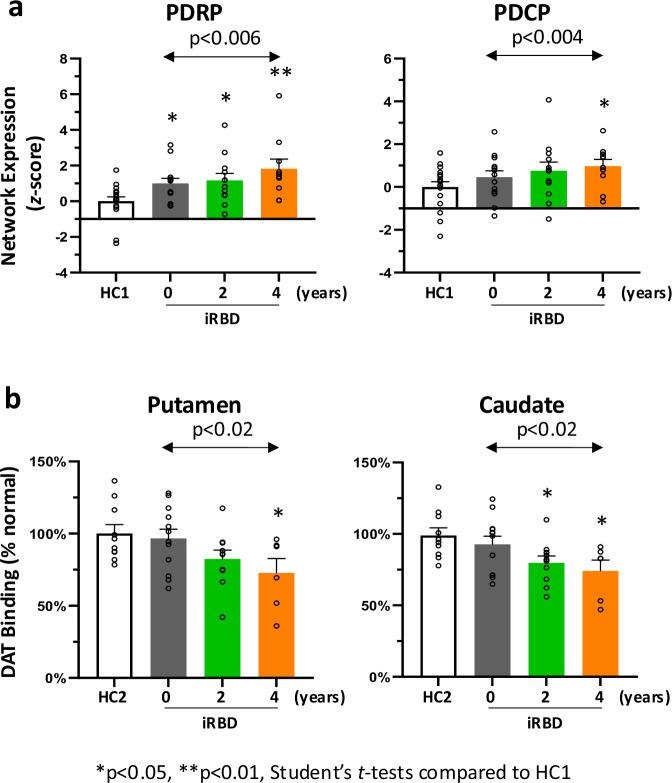 Longitudinal network changes and phenoconversion risk in isolated REM sleep behavior disorder.