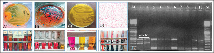 Use of ash filtrate as an alternative to chemical disinfectant and its antimicrobial efficacy.