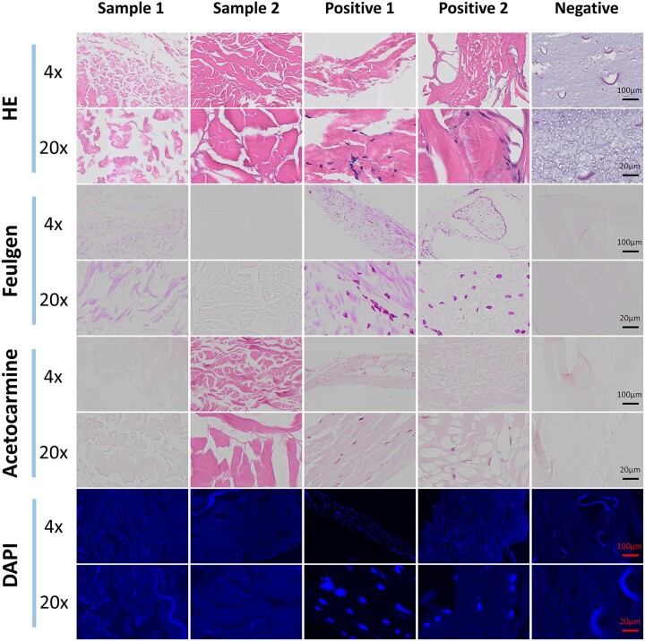 Semi-quantitative scoring criteria based on multiple staining methods combined with machine learning to evaluate residual nuclei in decellularized matrix.