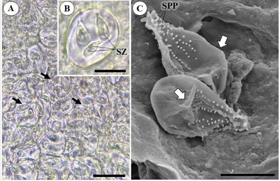 Morphological and histopathological description of Calyptospora sp. parasitism in Cichla monoculus Spix, 1929 (Osteichthyes, Cichlidae) from the lake region of Pracuúba-Amapá, Brazil.