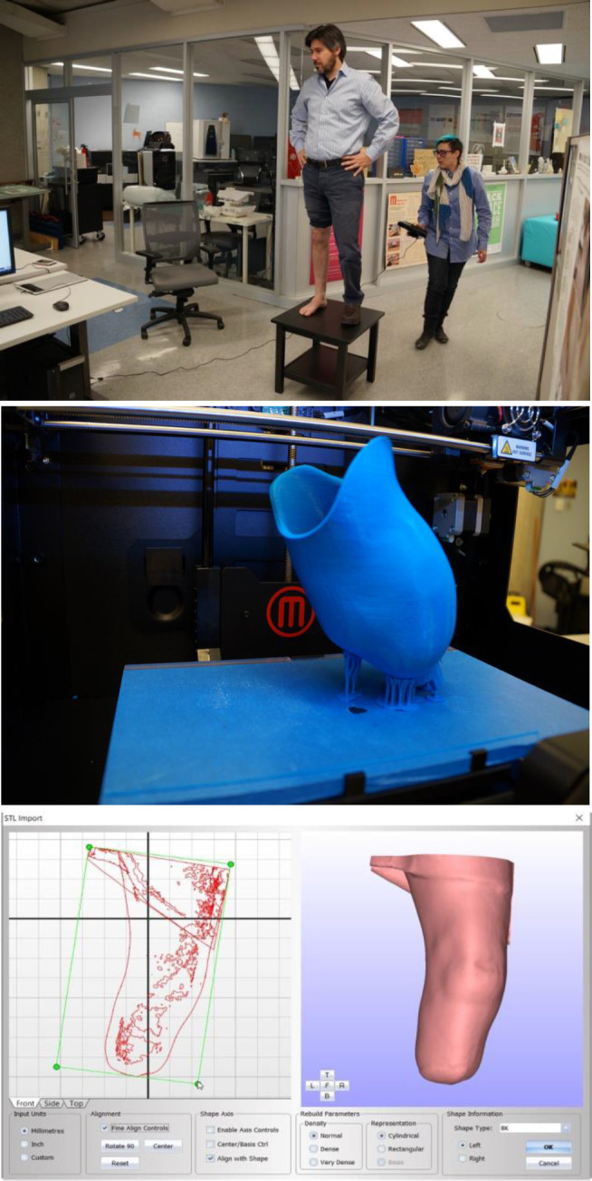 Prosthetist Knowledge and 3D Printing.