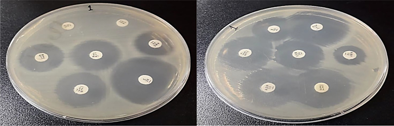 A fatal case of Vibrio cholerae-associated diarrhea and bacteremia in a 30-year-old carrier of beta-thalassemia.
