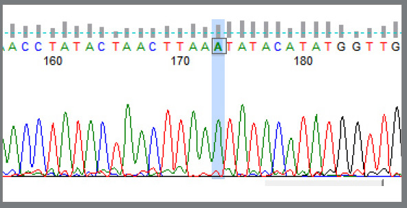 Genetic association between Class II division 1 and division 2 malocclusions with PAX9 (rs8004560) gene polymorphism in a tertiary care hospital.
