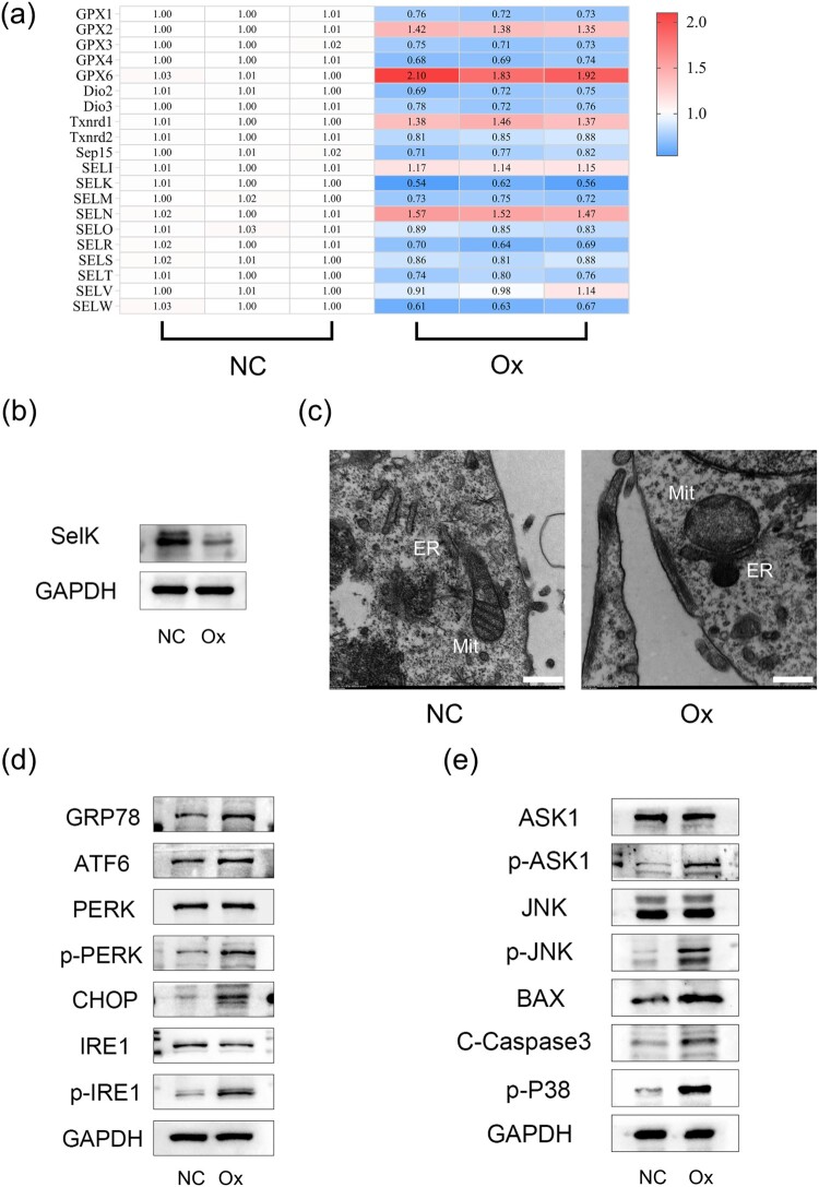 Selenium participates in the formation of kidney stones by alleviating endoplasmic reticulum stress and apoptosis of renal tubular epithelial cells.