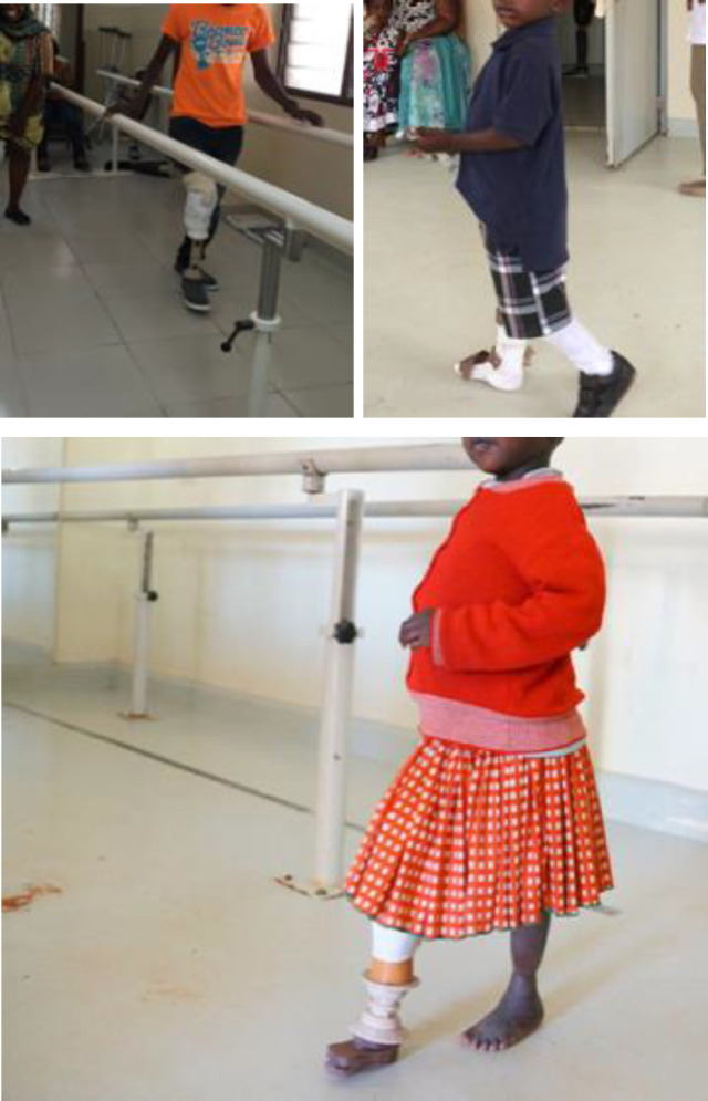 Prosthetist Knowledge and 3D Printing.