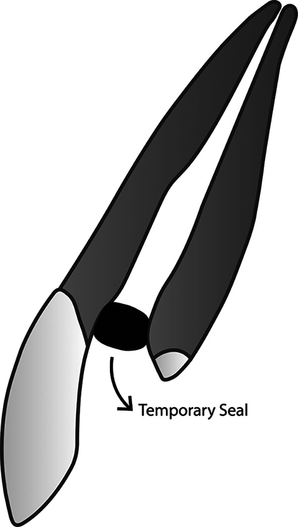Oxygen as obturation biomaterial in endodontic treatment: development of novel membranous dental restoration system.