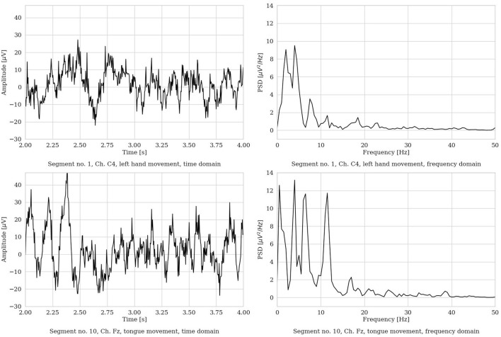hvEEGNet: a novel deep learning model for high-fidelity EEG reconstruction.