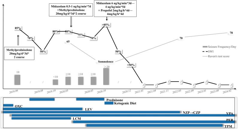 Efficacy of propofol and midazolam combination in managing refractory epileptic encephalopathy with spike-wave activation in sleep