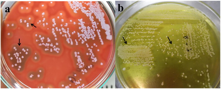 Antimicrobial resistance and virulence profiling of <i>Staphylococcus pseudintermedius</i> isolated from cats, Bangladesh.