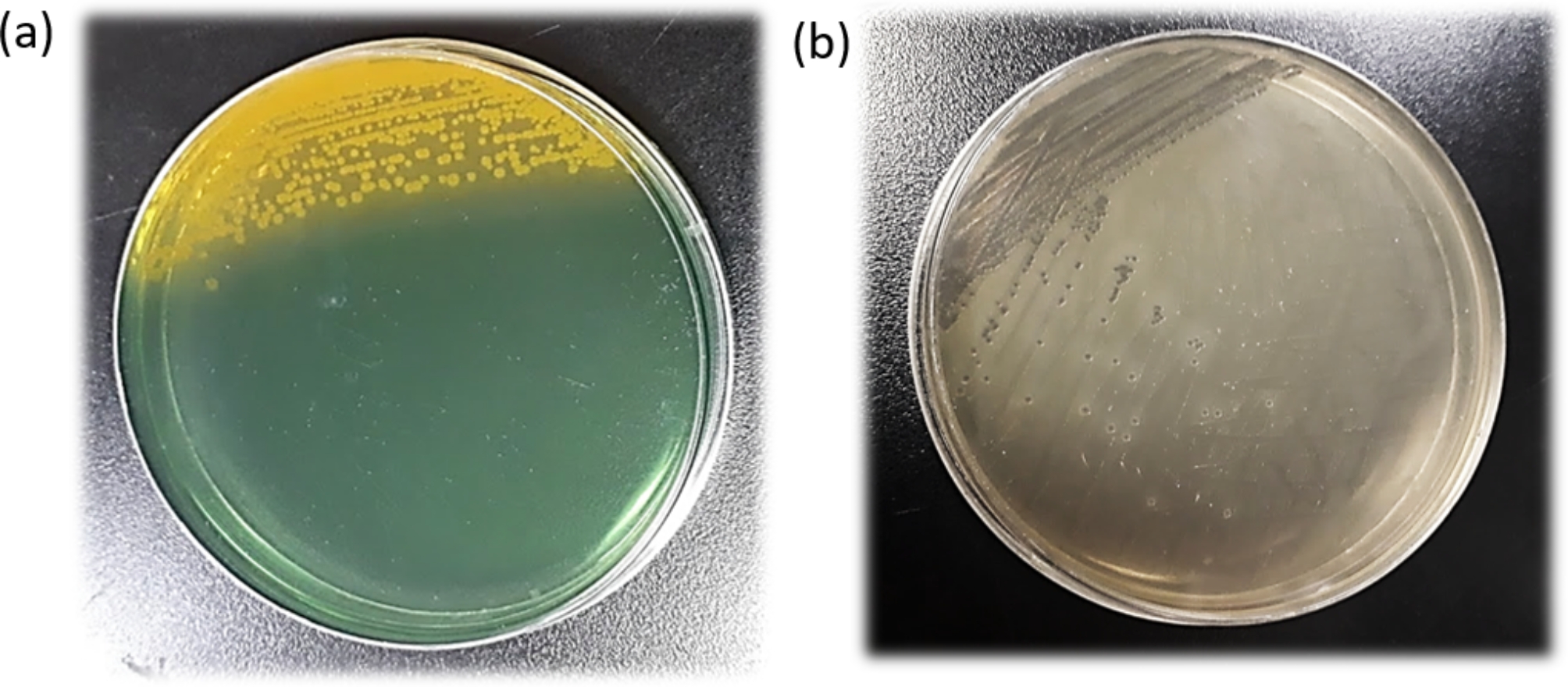 A fatal case of Vibrio cholerae-associated diarrhea and bacteremia in a 30-year-old carrier of beta-thalassemia.