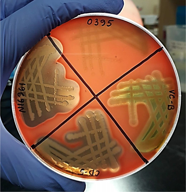 A fatal case of Vibrio cholerae-associated diarrhea and bacteremia in a 30-year-old carrier of beta-thalassemia.