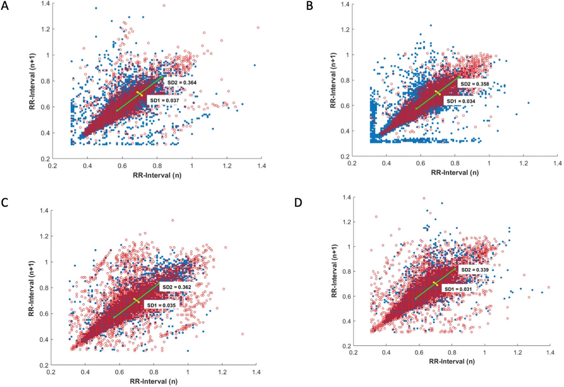 Prospective Observational Study of Sympathetic Failure as a Mechanism Associated with Bradycardia During Induction of General Anesthesia in Children with Down Syndrome.