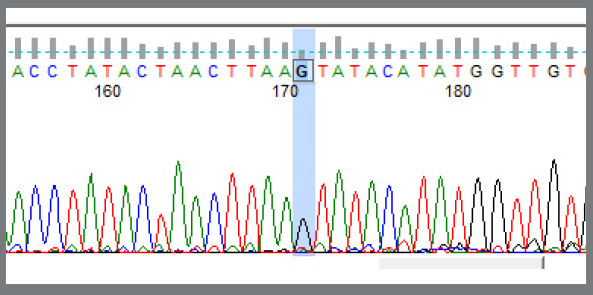 Genetic association between Class II division 1 and division 2 malocclusions with PAX9 (rs8004560) gene polymorphism in a tertiary care hospital.