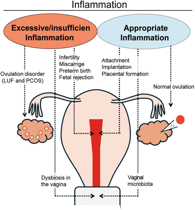 Inflammatory responses in early pregnancy: Physiological and pathological perspectives.