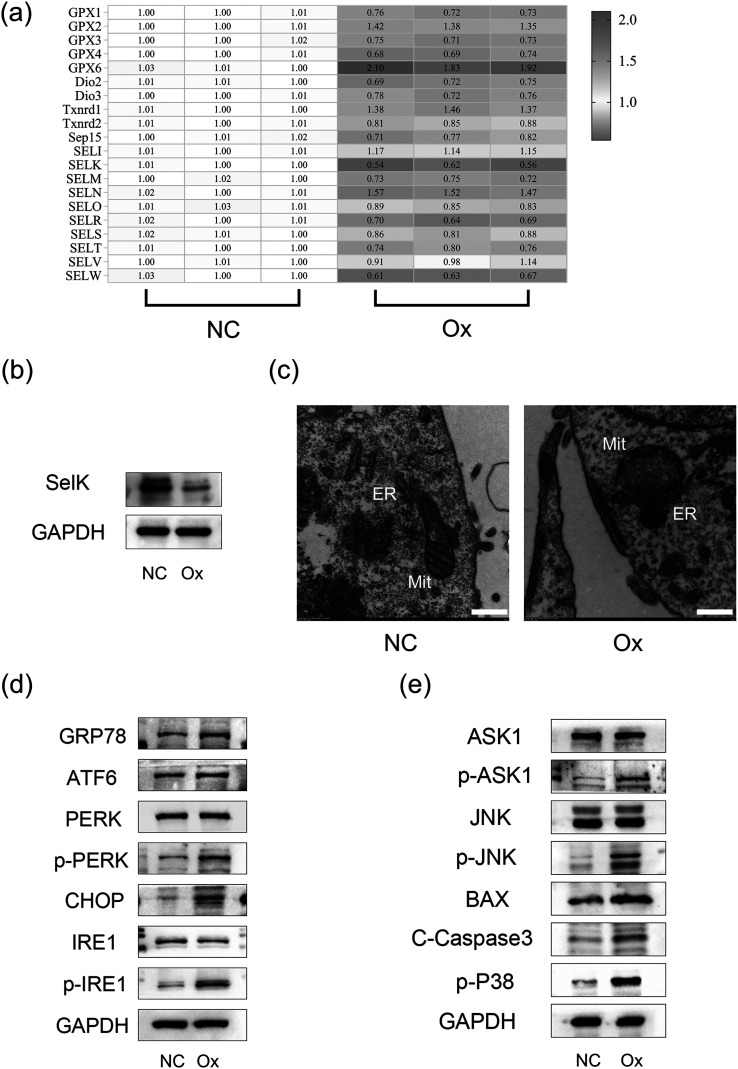 Selenium participates in the formation of kidney stones by alleviating endoplasmic reticulum stress and apoptosis of renal tubular epithelial cells.