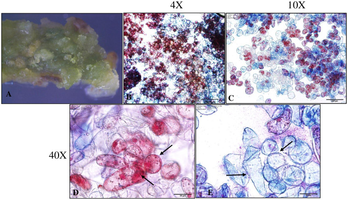 Somatic embryogenesis and shoot organogenesis in peanut cv. 'Georgia-12Y' and successful transfer to the soil.