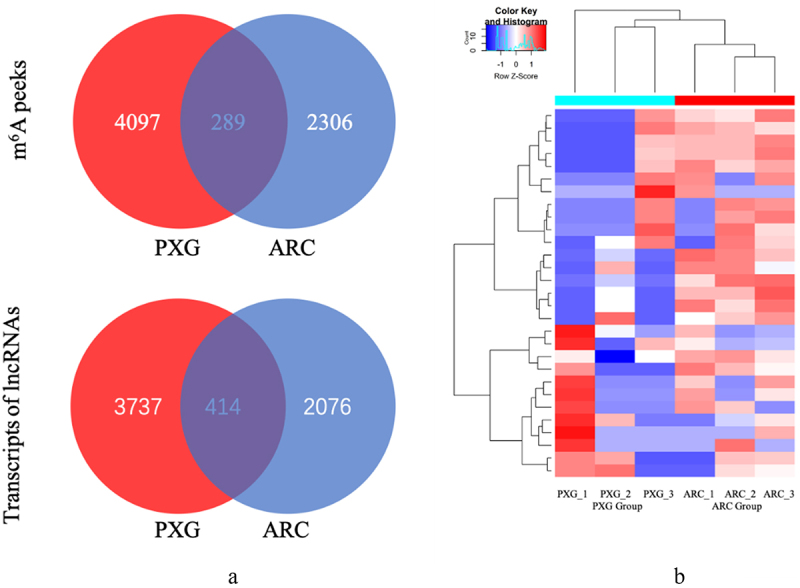 Role of N6-methyladenosine-related lncRnas in pseudoexfoliation glaucoma.