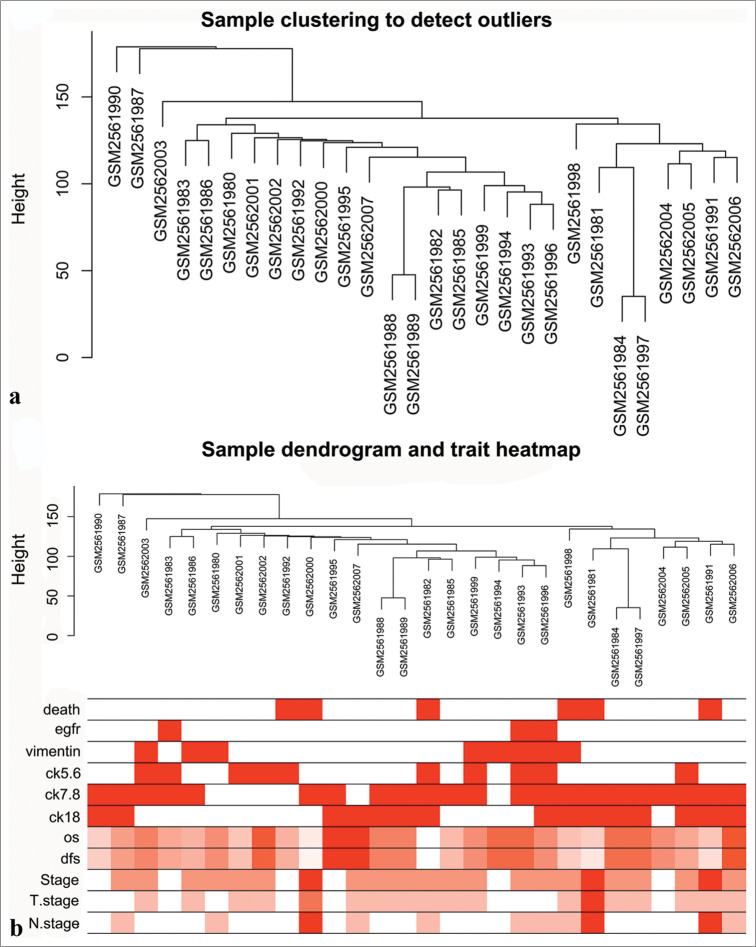 Identification of transcription factors associated with the disease-free survival of triple-negative breast cancer through weighted gene co-expression network analysis.