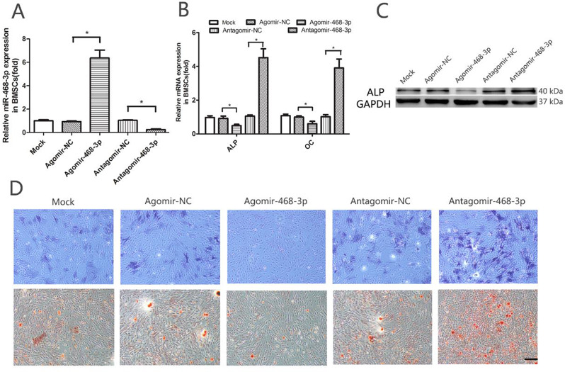 miR-468-3p suppresses osteogenic differentiation of BMSCs by targeting Runx2 and inhibits bone formation.