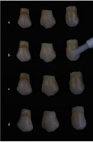 The Effect of Different Bleaching Techniques Using 6% Hydrogen Peroxide: Penetration Inside the Pulp Cavity, Bleaching Efficacy and Toxicity.