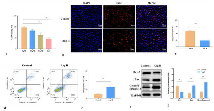 Prenyl diphosphate synthase subunit 2 is downregulated in abdominal aortic aneurysm and retards the progression of abdominal aortic aneurysm.