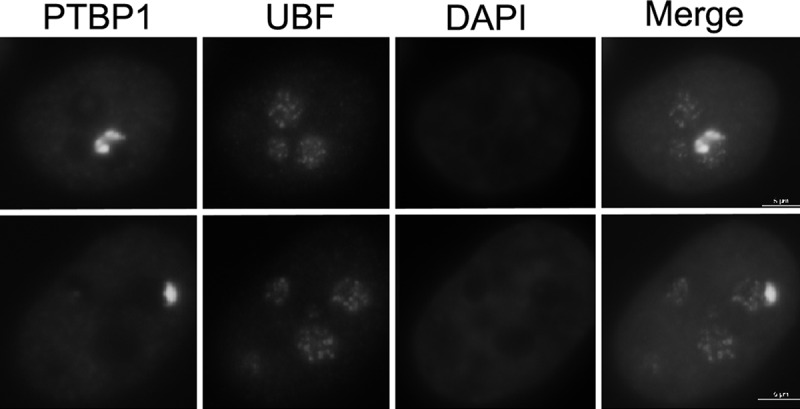The perinucleolar compartment: structure, function, and utility in anti-cancer drug development.