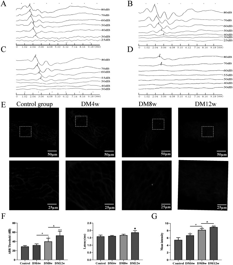 Hyperglycemia-induced oxidative stress exacerbates mitochondrial apoptosis damage to cochlear stria vascularis pericytes via the ROS-mediated Bcl-2/CytC/AIF pathway.